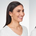 What is the price difference between botox and juvederm?